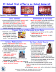 Adult Oral Health Poster  Spanish